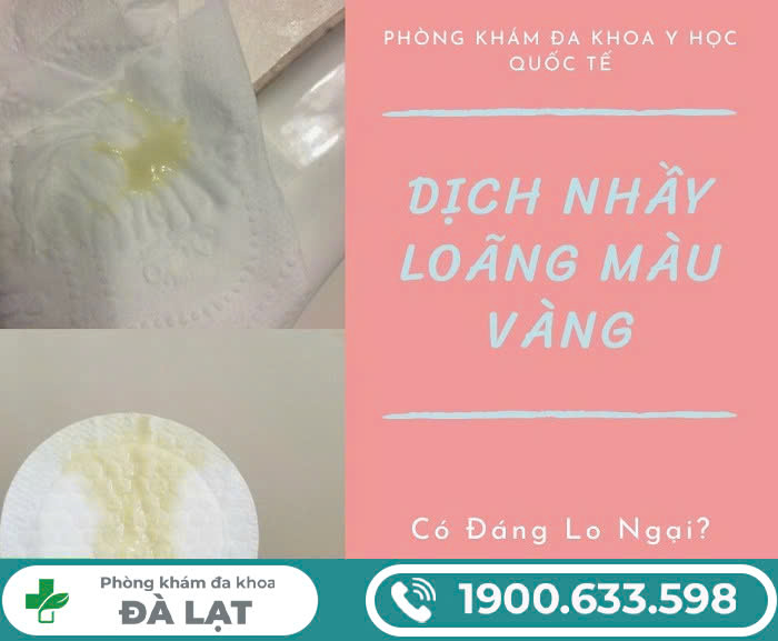 Hình ảnh minh họa